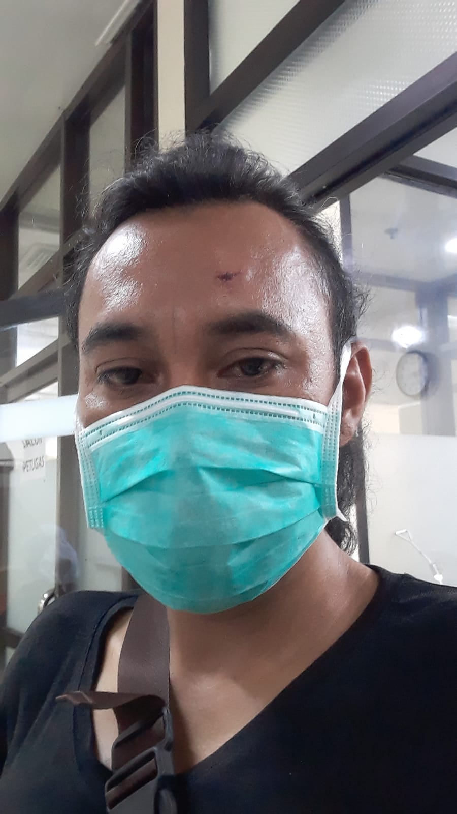 Albert Korban Penganiayaan Oknum Anggota Brimob, Laporkan Ke Polres Metro Tangerang